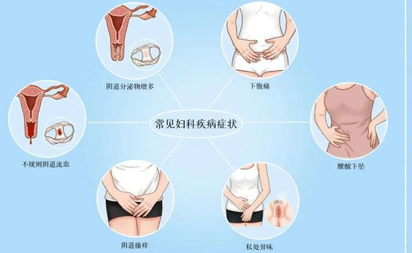 女性生殖器痒用什么药（女性生殖痒是怎么回事?）-图1