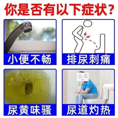 长期尿黄吃什么药好（长期尿黄可能是三种病）-图3