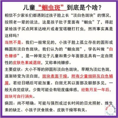 吃蛔虫药需要注意什么（吃蛔虫药注意什么事项）-图3