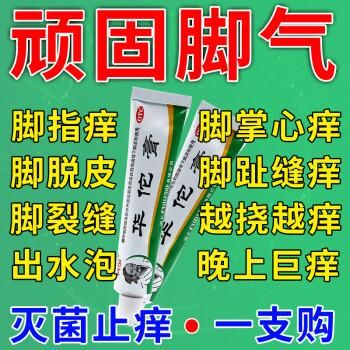 脚气搽什么药（脚气搽什么药膏效果最好）-图3