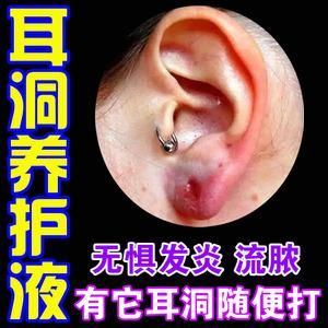 耳洞打了用什么药消炎药吗（打了耳洞后用什么消炎）-图1