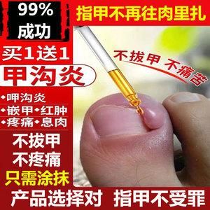 切指甲涂什么药（指甲切伤敷什么药好得快）