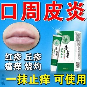 口周皮炎用什么药（口周皮炎用什么药有效）-图3