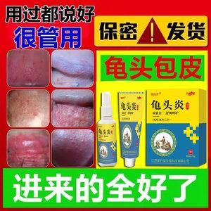 阴轻龟头炎用什么药的简单介绍-图2