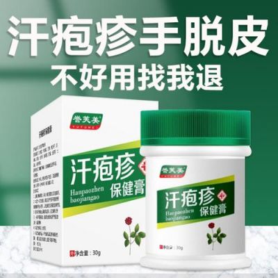 手癣用什么药（儿童手癣用什么药）-图1