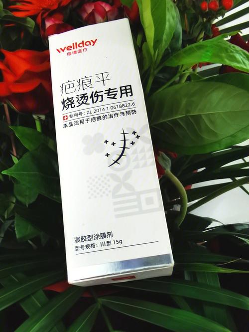 轻度烧伤用什么药（轻度烧伤吃什么药）-图3