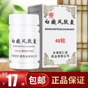 治白斑药什么卤米药（治白斑药什么卤米药好）-图2