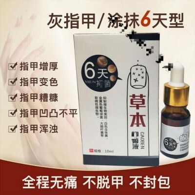 灰指甲用什么抹的药（灰指甲用什么药涂抹）-图2