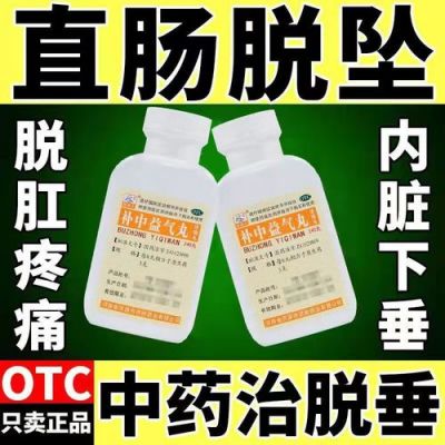 大便脱肛用什么药（大便脱肛用什么药管用）-图3