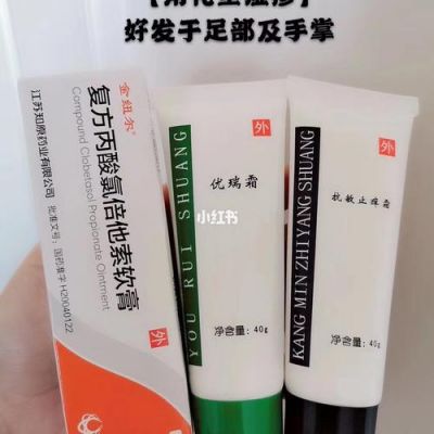 湿疹角化用什么药（角化湿疹用什么药最好）-图2