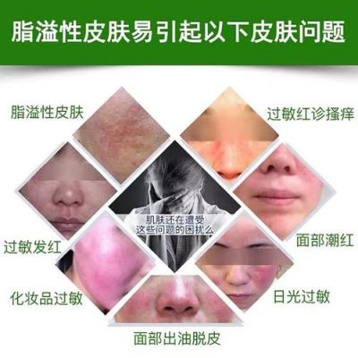 脸上起疙瘩痒吃什么药（脸上起疙瘩痒用什么药）-图3