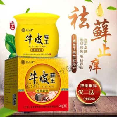 牛皮顽癣用什么药（牛皮顽癣特效偏方草药）-图3