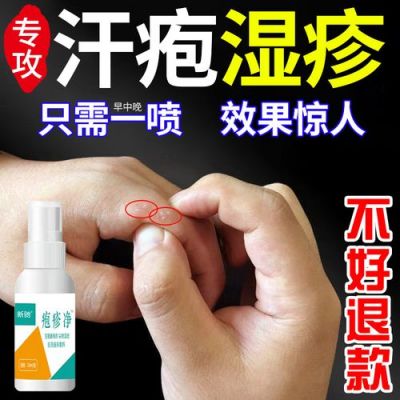 起小水泡用什么药（起小水泡用什么药最好）