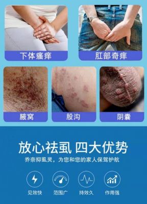 治疗阴虱什么药最好（治疗阴虱什么药最好使）-图1